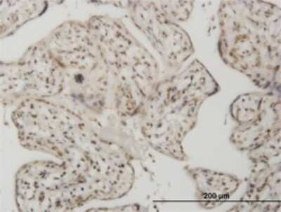 Immunohistochemistry-Paraffin: Smad1 Antibody (2A1) [H00004086-M04]