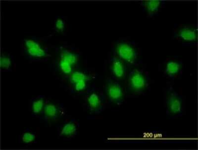 Immunocytochemistry/ Immunofluorescence: Smad1 Antibody (2E9) [H00004086-M03]