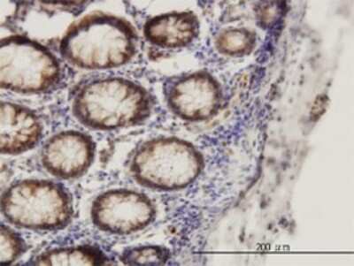 Immunohistochemistry-Paraffin: Smad1 Antibody (2E9) [H00004086-M03]