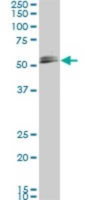 Western Blot: Smad1 Antibody (2E9) [H00004086-M03]