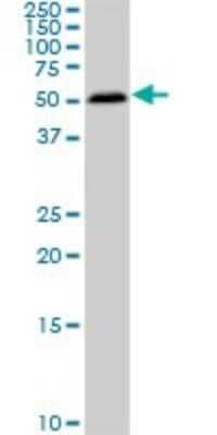 Western Blot: Smad1 Antibody (2E9) [H00004086-M03]