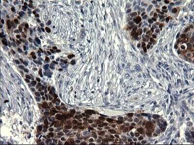 Immunohistochemistry: Smad1 Antibody (OTI1C5) - Azide and BSA Free [NBP2-74236]