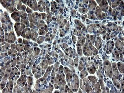 Immunohistochemistry: Smad1 Antibody (OTI1C5) - Azide and BSA Free [NBP2-74236]