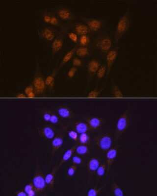 Immunocytochemistry/ Immunofluorescence: Smad2 Antibody (2E3D8) [NBP3-15671]