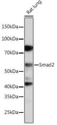 Western Blot: Smad2 Antibody (2E3D8) [NBP3-15671]