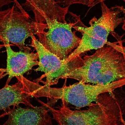 Immunocytochemistry/ Immunofluorescence: Smad2 Antibody (5G7) - BSA Free [NBP2-37580]