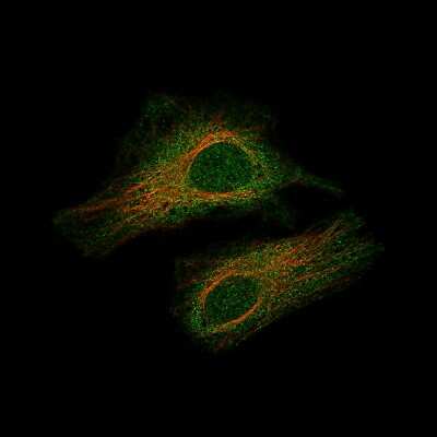 Immunocytochemistry/ Immunofluorescence: Smad2 Antibody (CL8472) [NBP2-88916]
