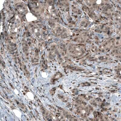 Immunohistochemistry-Paraffin: Smad2 Antibody (CL8472) [NBP2-88916]
