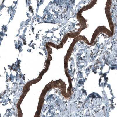 Immunohistochemistry-Paraffin: Smad2 Antibody (CL8472) [NBP2-88916]