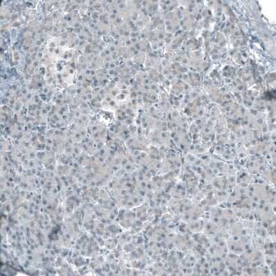 Immunohistochemistry-Paraffin: Smad2 Antibody (CL8472) [NBP2-88916]