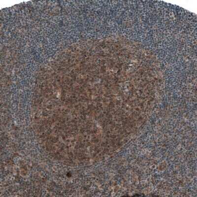 Immunohistochemistry-Paraffin: Smad2 Antibody (CL8472) [NBP2-88916]