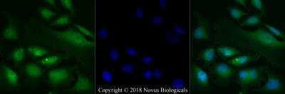 Immunocytochemistry/ Immunofluorescence: Smad3 Antibody [NB100-56479]