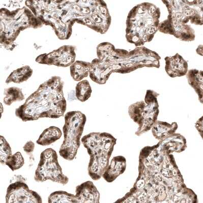 Immunohistochemistry-Paraffin: Smad4 Antibody (CL9774) [NBP3-05507]
