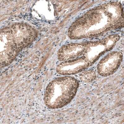 Immunohistochemistry-Paraffin: Smad4 Antibody (CL9774) [NBP3-05507]