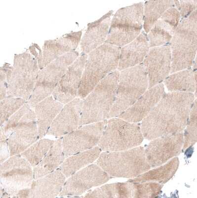 Immunohistochemistry-Paraffin: Smad4 Antibody (CL9774) [NBP3-05507]