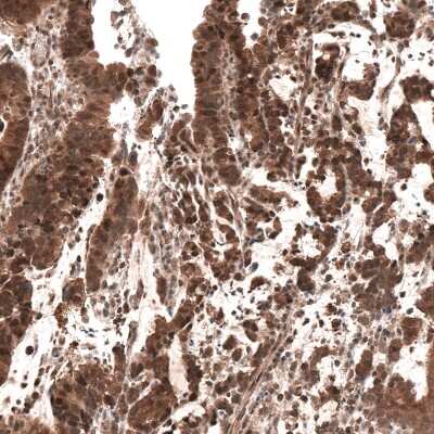 Immunohistochemistry-Paraffin: Smad4 Antibody (CL9774) [NBP3-05507]
