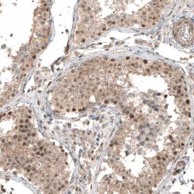 Immunohistochemistry-Paraffin: Smad4 Antibody (CL9774) [NBP3-05507]