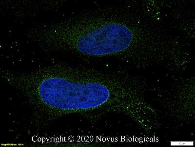 Immunocytochemistry/ Immunofluorescence: Smad4 Antibody [NBP2-24951]