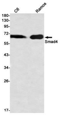 Western Blot: Smad4 Antibody (S05-1I7) [NBP3-19919]