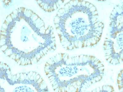 Immunohistochemistry-Paraffin: Smad4 Antibody (SMAD4/2440) - Azide and BSA Free [NBP3-08320]
