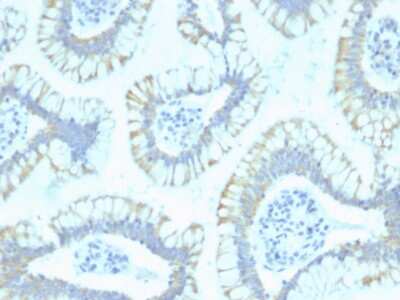 Immunohistochemistry-Paraffin: Smad4 Antibody (SPM448) - Azide and BSA Free [NBP3-08344]