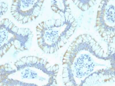 Immunohistochemistry-Paraffin: Smad4 Antibody (SPM448) [NBP3-07263]