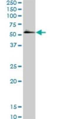 Western Blot: Smad5 Antibody (2D7) [H00004090-M01]