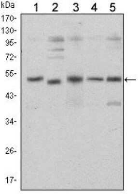 Western Blot: Smad5 Antibody (3H9)BSA Free [NBP2-37648]