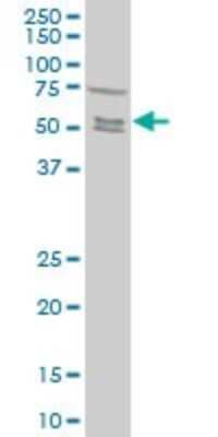 Western Blot: Smad5 Antibody (4F10) [H00004090-M05]