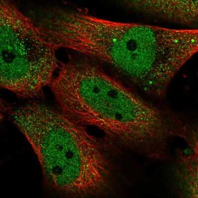 Immunocytochemistry/ Immunofluorescence: Smad5 Antibody [NBP2-32406]