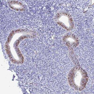 Immunohistochemistry-Paraffin: Smad5 Antibody [NBP2-32406]