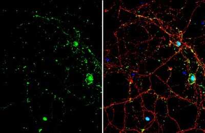 Immunocytochemistry/ Immunofluorescence: Smad7 Antibody [NBP3-13375]