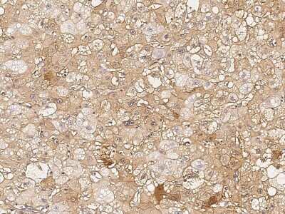 Immunohistochemistry-Paraffin: Smad7 Antibody [NBP2-98971]