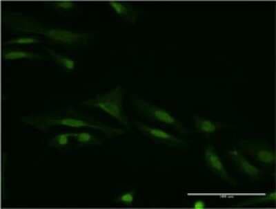 Immunocytochemistry/ Immunofluorescence: Smad9 Antibody (3H2) [H00004093-M05]