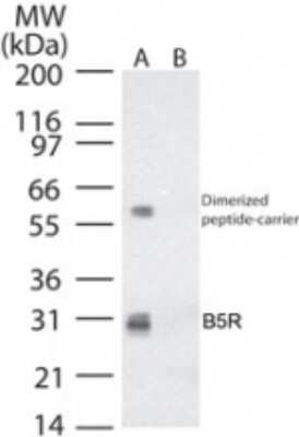 Western Blot: Smallpox B5R Antibody [NB100-56455]