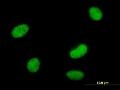 Immunocytochemistry/ Immunofluorescence: SmarcAL1 Antibody [H00050485-B01P]