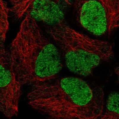 Immunocytochemistry/ Immunofluorescence: SmarcAL1 Antibody [NBP2-13352]