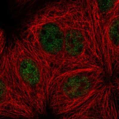 Immunocytochemistry/ Immunofluorescence: Smek1 Antibody [NBP2-56478]
