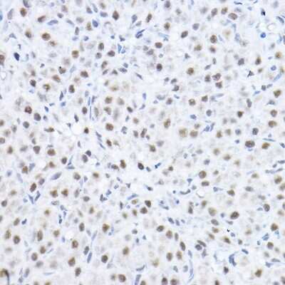 Immunohistochemistry-Paraffin: Smek1 Antibody - BSA Free [NBP2-94709]