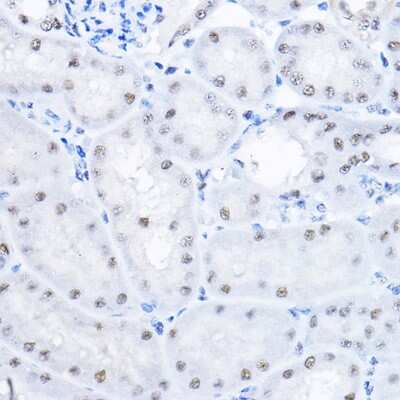Immunohistochemistry-Paraffin: Smek1 Antibody - BSA Free [NBP2-94709]