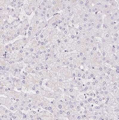 Immunohistochemistry-Paraffin: Smoothelin Antibody [NBP2-37931]