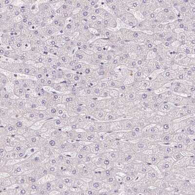 Immunohistochemistry-Paraffin: Smoothelin Antibody [NBP2-37971]