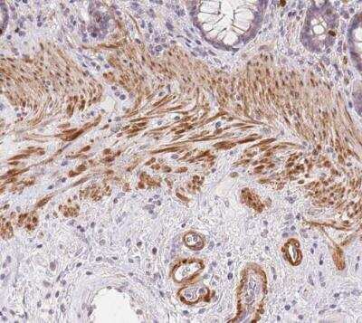 Immunohistochemistry-Paraffin: Smoothelin Antibody [NBP2-37971]