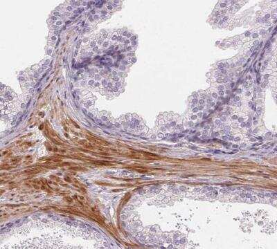 Immunohistochemistry-Paraffin: Smoothelin Antibody [NBP2-37971]
