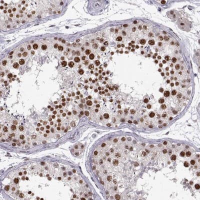 Immunohistochemistry-Paraffin: Snail Antibody (CL3700) [NBP2-61631]