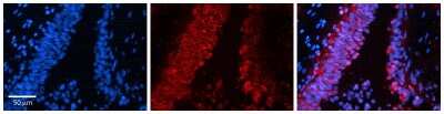 Immunohistochemistry-Paraffin: Snail Antibody [NBP1-80022]