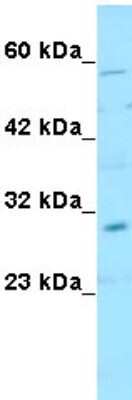 Western Blot: Snail Antibody [NBP1-80022]