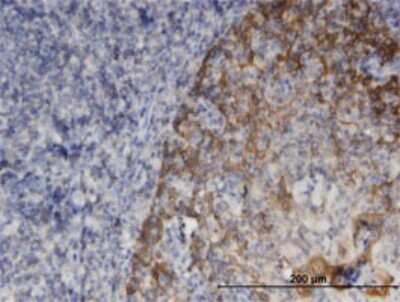 Immunohistochemistry-Paraffin: Snapin Antibody (3H1) [H00023557-M01]