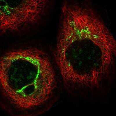 Immunocytochemistry/ Immunofluorescence: Snapin Antibody [NBP1-92414]