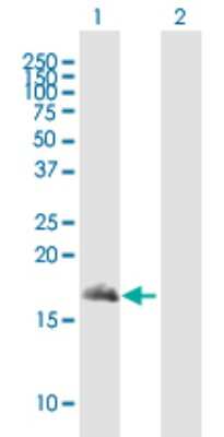 Western Blot: Snapin Antibody [H00023557-B01P]